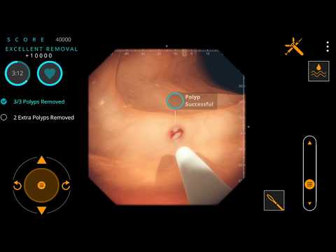 Gastro Ex: Played by Gastroent Video