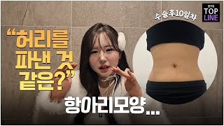 VLOG 2탄. 복부지방흡입 후, 10일차