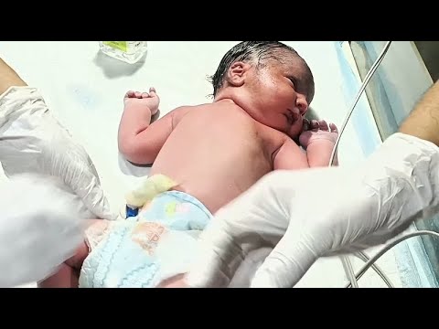 Newborn Baby First Examination | Cyanosis, Oxygen Therapy & Vitamin K Injection | NICU Care