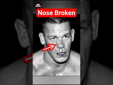 Top 3 wrestlers who suffered heavy injur! because of Seth Rollins #wwe #wweraw