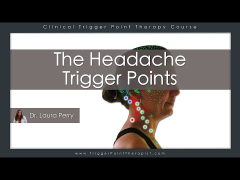The Headache Trigger Points