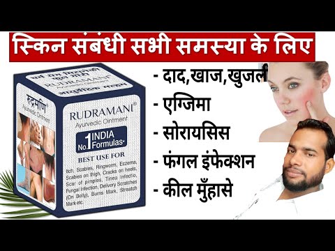 Eczema medicine cream rudramani skin eczema fungal infection...
