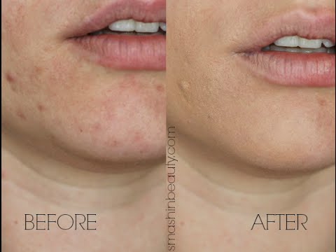 amazing concealer corrector