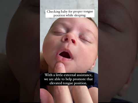 Check your baby for proper tongue position #babies #tonguetie #sleep