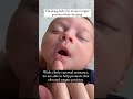 Check your baby for proper tongue position #babies #tonguetie #sleep