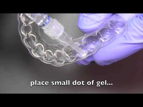 How to use and maintain custom teeth whitening trays by Helm | Nejad | Stanley - Dentistry