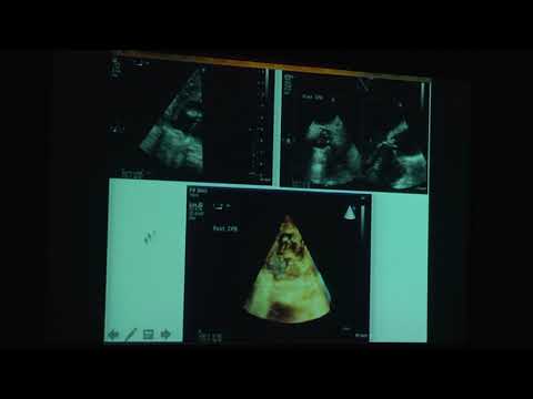 20180824_28_ Prosthetic_valves_ Thomas_Koshy_Dr