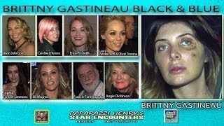 Brittny Castineau's black eye! Kym Johnson, Angie Dickinson, more