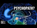 She Studied Extreme Psychopaths Here S What It Taught Her About Human Nature Abigail Marsh