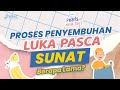 PROSES PENYEMBUHAN LUKA PASCA SUNAT BERAPA LAMA