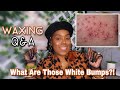 Why Do I Get White Bumps After Waxing? | Adore Her Beauty