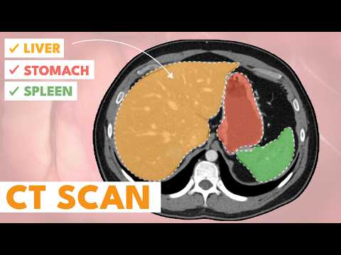 How to read a CT scan (2/2) | A beginner's guide