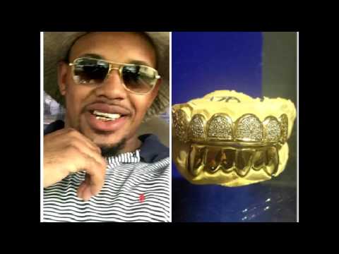 Gold Teeth Grillz In Lafayette, La (337) 414-2681