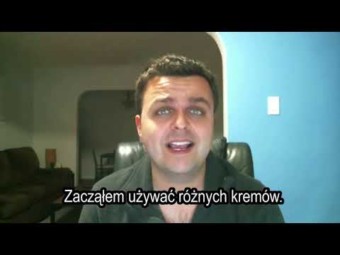 Oznacza rozjaśnić włosy na ciele Powody spadające włosy