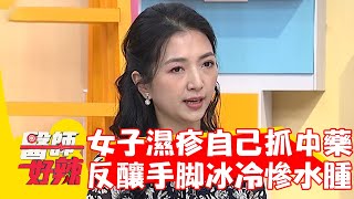53歲女濕疹自己抓中藥！反釀手腳冰冷慘水腫？！【#醫師好辣】20230402 part4 EP1519 陳榮堅 羅珮琳
