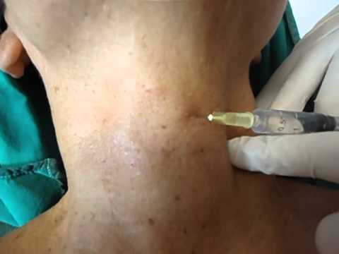 Maschere per occhi naturali Dalla quale argilla è migliore per fare un pacco di faccia