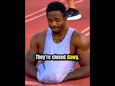 Stokes Twins meet the man who only has one leg😳