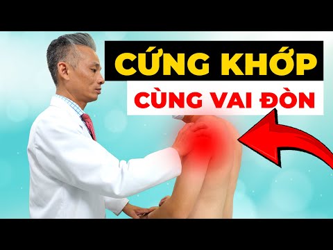 Đau Nhói Khớp Vai Không Nhấc Nổi Tay? Khớp Cùng Vai Đòn Đang Kêu Cứu