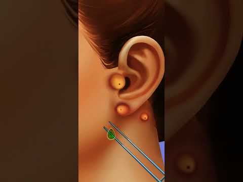 ASMR Limpeza no ouvido satisfatório sonoras que rejuvenescem mente e pele