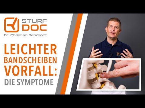 Leichter Bandscheibenvorfall - Die Symptome