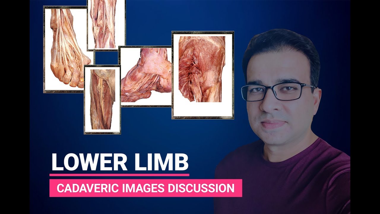 LOWER LIMB CADAVERIC IMAGES DISCUSSION