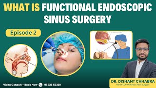 What is Functional Endoscopic Sinus Surgery (FESS)? | Dr. Dishant Chhabra | ENT Specialist Explains