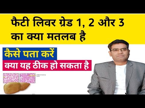 Fatty liver grade 1, 2 and 3 Means? what are Symptoms and is it Curable  or Treatable