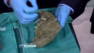 What Alcohol Can Do To Your Liver