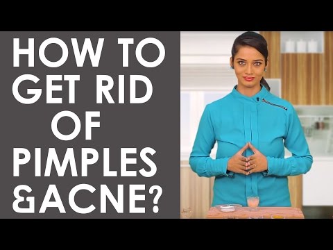 おでこのニキビを取り除くために3つの簡単なホームレメディ (3 Simple Home Remedies To Get Rid Of Pimples On Forehead)
