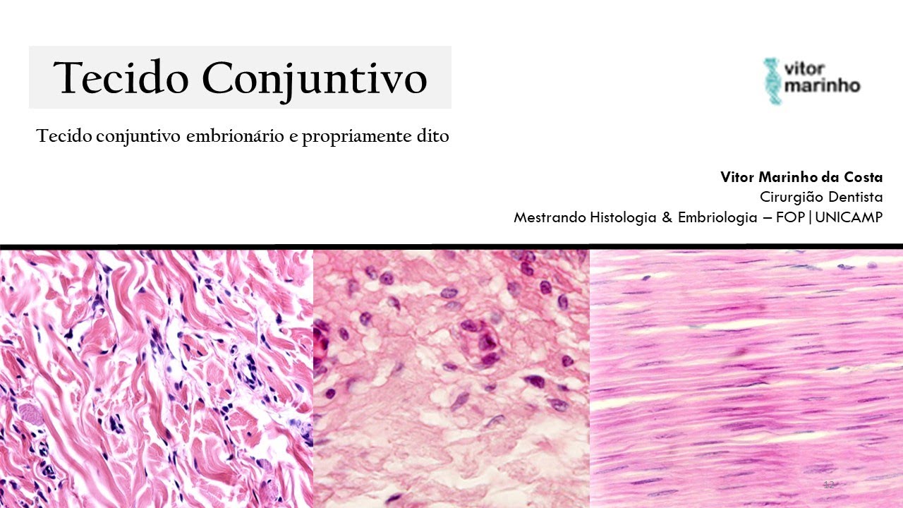 Tecido conjuntivo propriamente dito (Classificação)