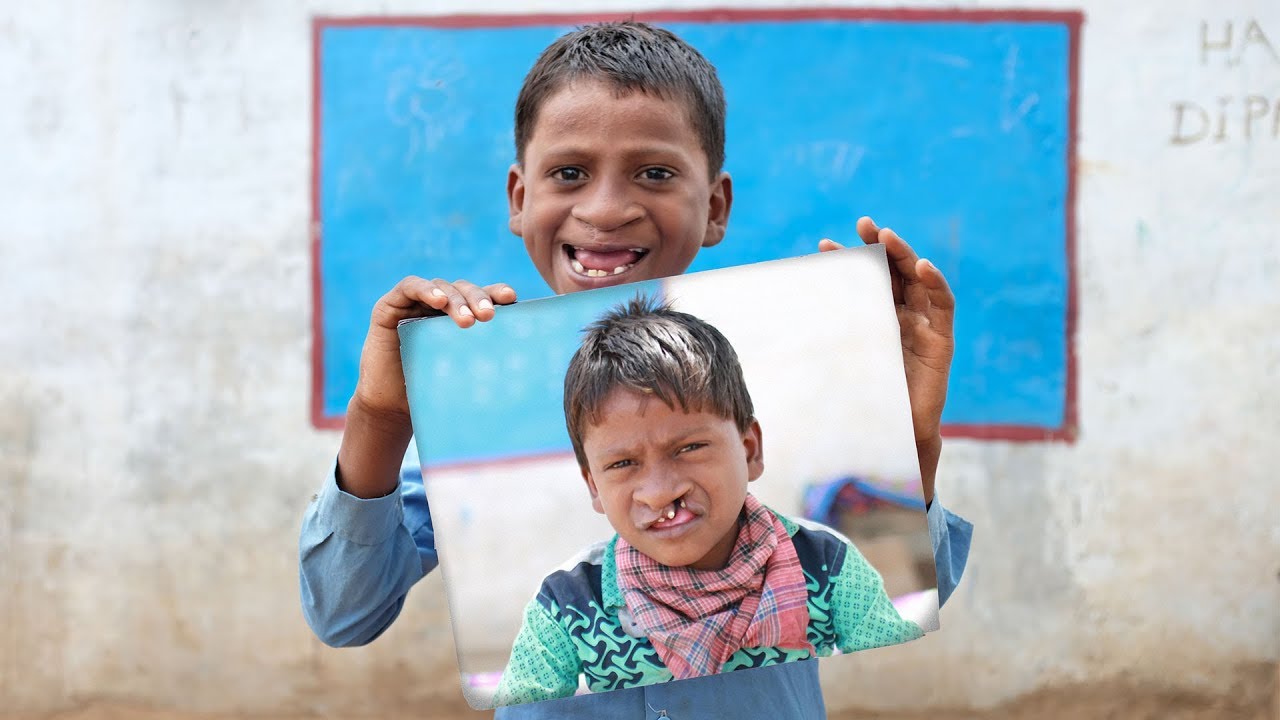Vikas | 360° Smiles