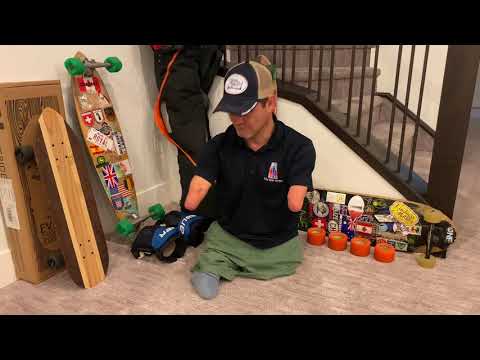 Chris Koch - Why are you missing arms and legs?