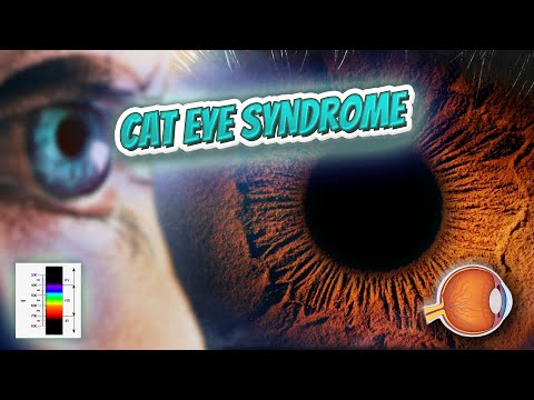 Cat eye syndrome - Your EYEBALLS - EYNTK 👁️💉😳💊🔊💯✅