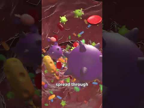 Dead Man Kills Warrior 😮