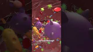 Dead Man Kills Warrior 😮