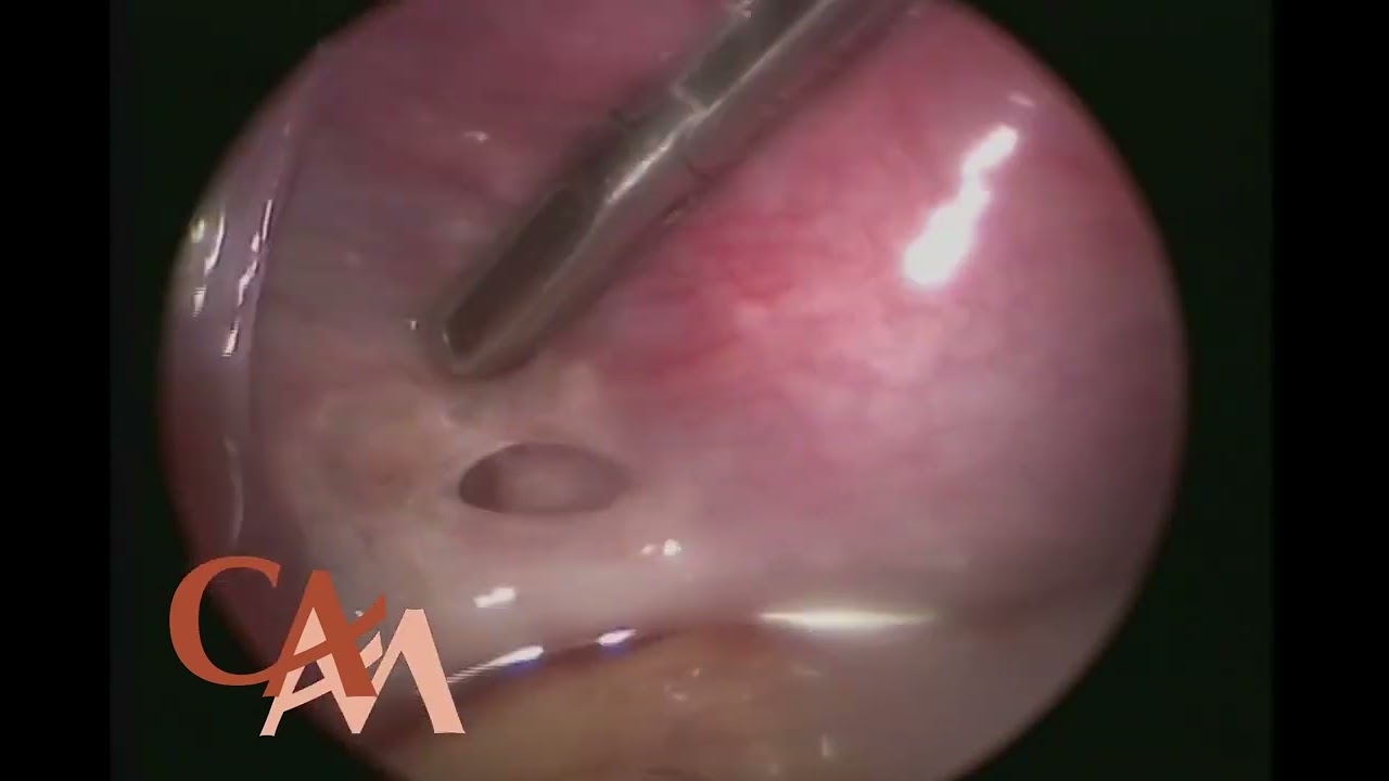 Carlos Alberto Alfaro Miranda-4