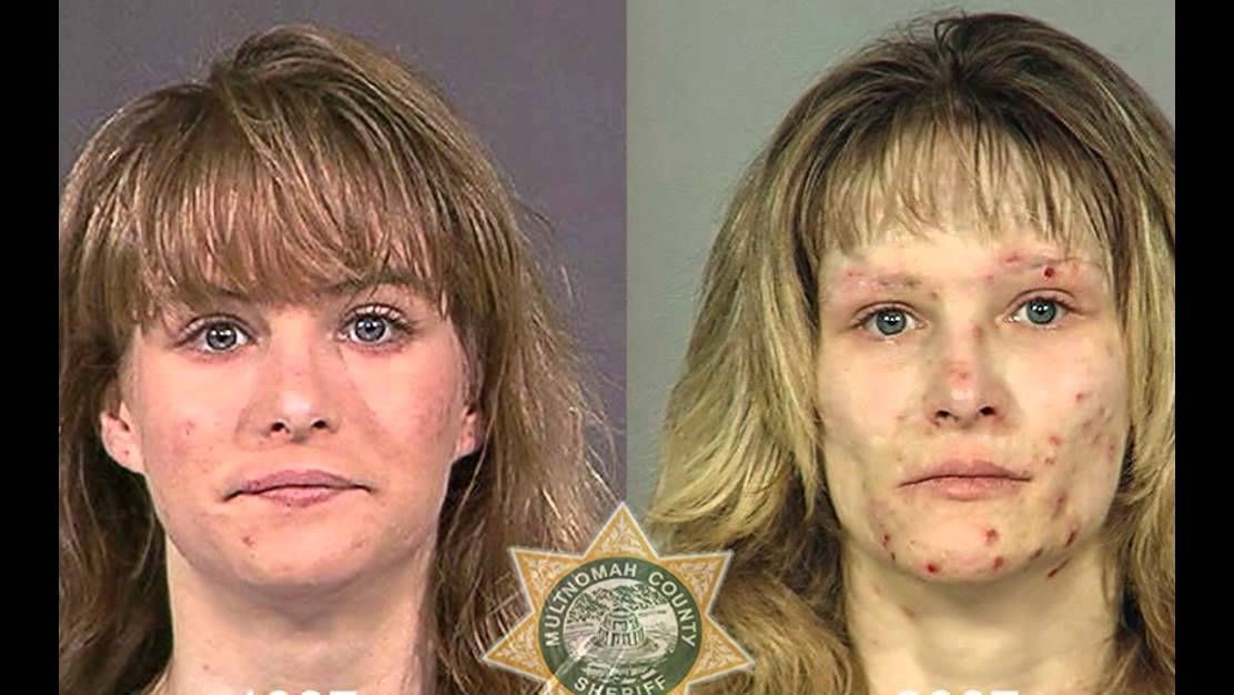 Faces of Meth:  Shocking mugshot photos show toll of drugs and alcohol on US criminals