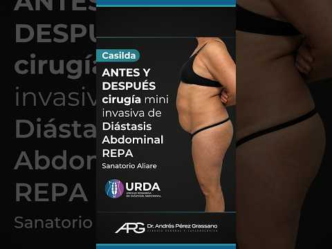 Antes y Después de una paciente de Buenos Aires Casilda, Santa Fe