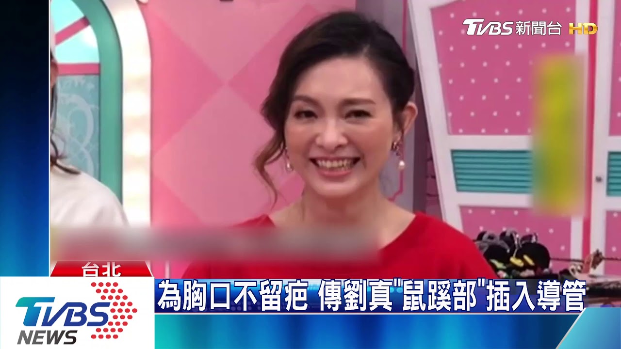 劉真裝「人工肺」續命? 醫:若狀況差、氧合不足
