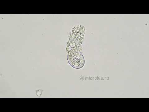 Tardigrade egg hatching/ Вылупление тихоходки