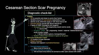 5-Caesarean section scar pregnancy