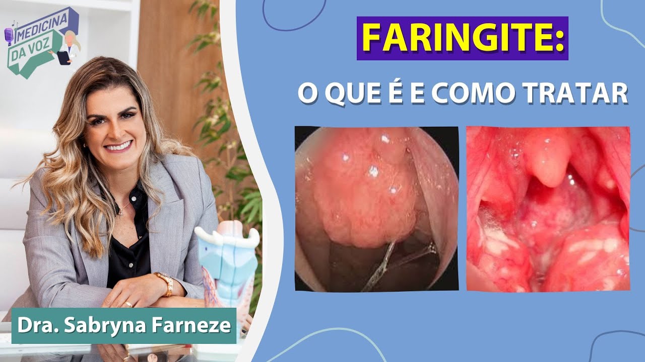 Faringite, o que é e como tratar!