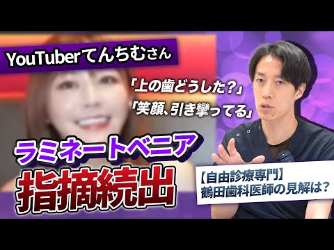YouTuberてんちむさんの審美歯科治療に賛否!?自由診療専門医はどういった見解に?【ラミネートベニア】