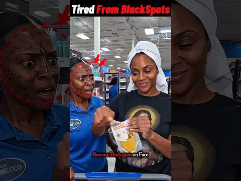 Black Spots Gone Instantly!