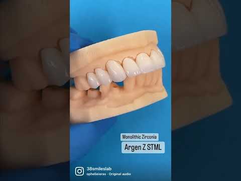 Monolithic Zirconia!!! Check out those translucency on the incisal!!! 🦷🦷🦷