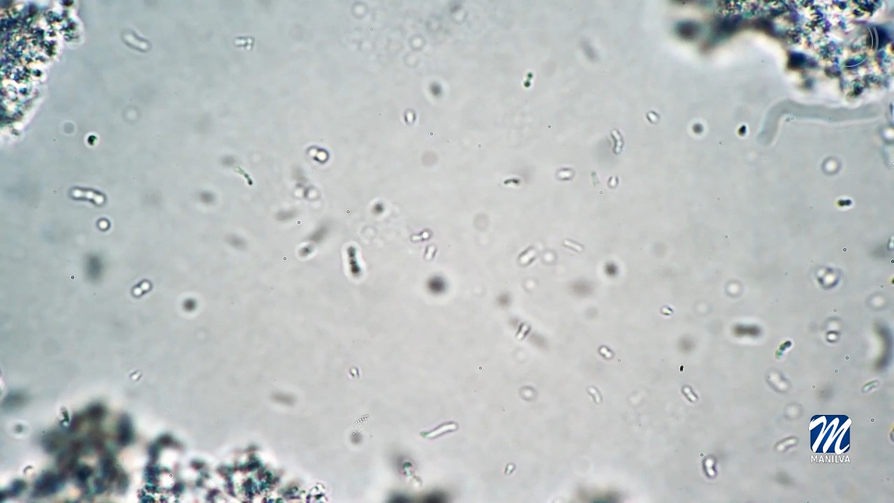 Recomendaciones para prevenir la legionella en los hogares