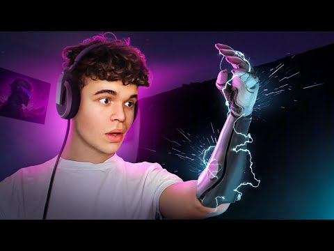 $50,000 Bionic Arm That Changed My Life!