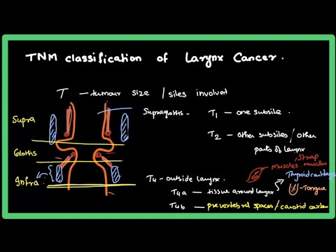 Larynx cancer | TNM Classification | AJCC