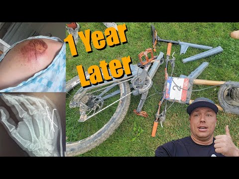 1 Year Later - Frame Implosion