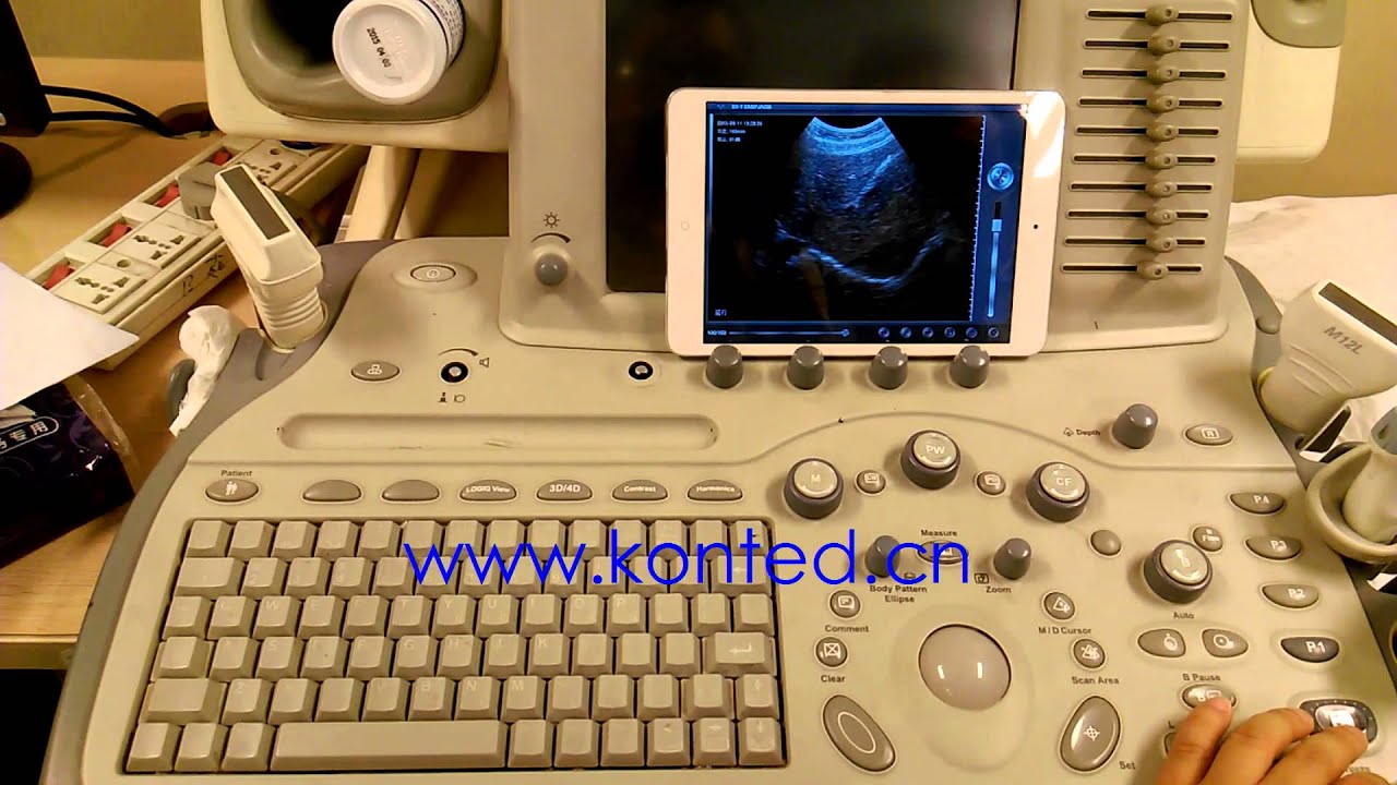 Beijing Konted wireless convex probe